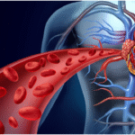 Here Are 7 Warning Signs You Have Blocked Arteries
