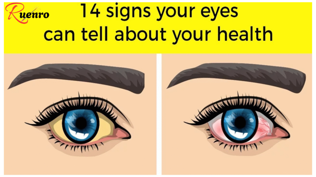 14 Things Your Eyes Are Trying to Tell You About Your Health
