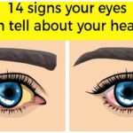 14 Things Your Eyes Are Trying to Tell You About Your Health