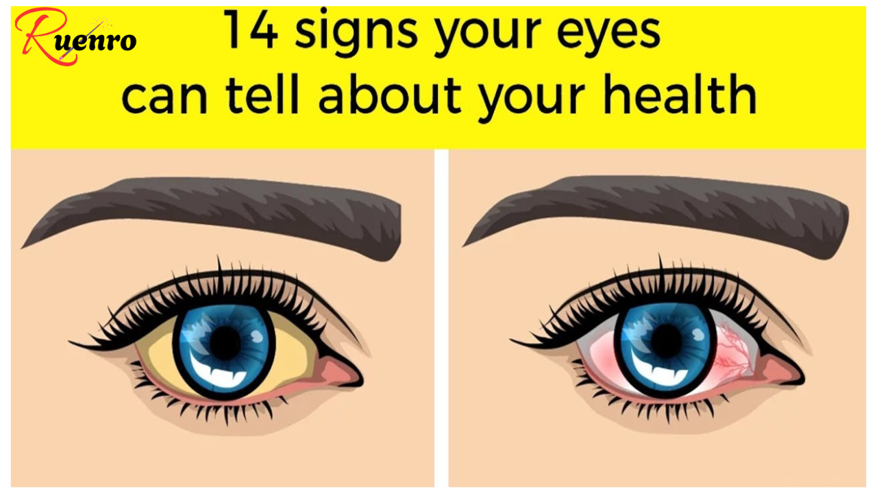 14 Things Your Eyes Are Trying to Tell You About Your Health