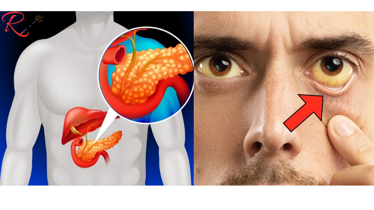 5 Warning Signs Your Pancreas Is in Trouble