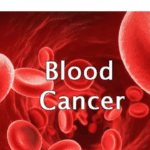 The 11 signs of blood cancer