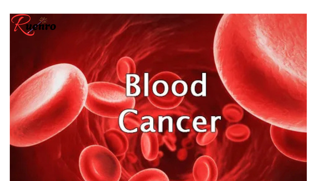 The 11 signs of blood cancer