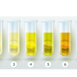 What the Color of Your Urine Says About Your Health