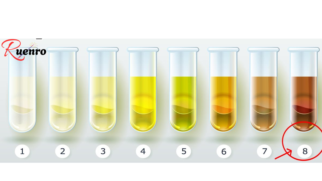 What the Color of Your Urine Says About Your Health