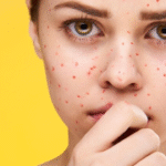 What Do These Red Dots on Your Skin Mean