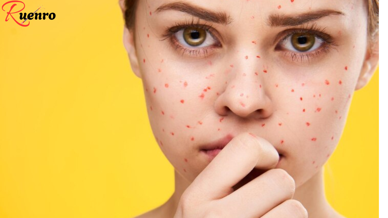 What Do These Red Dots on Your Skin Mean