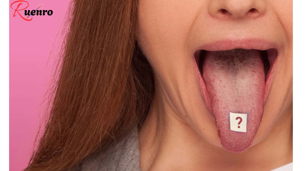 What Your Tongue Reveals About Your Health
