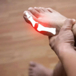 How to Stop a Gout Attack